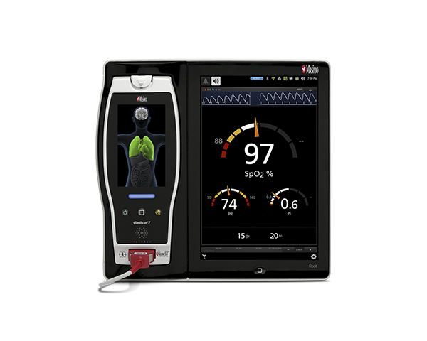 Root patient monitor with Radical-7 docked and measuring the levels of various blood constituents.