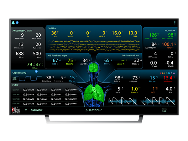 UniView<sup><sup>®</sup></sup>